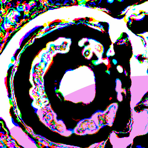 Enlarged, unblurred surface detail of Approach, showing individual colors.